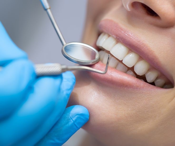 Dental Habit