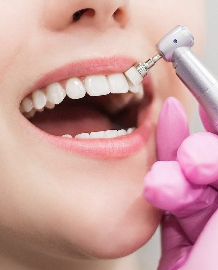 Dental Habit