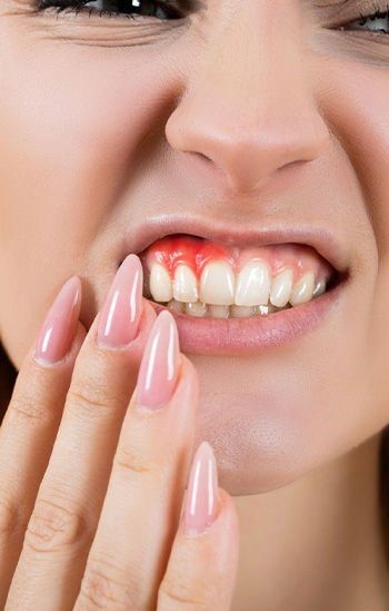 Gum Disease Treatment